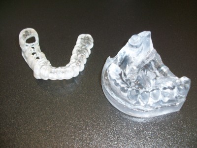 Set of teeth created using 3D printing technology
